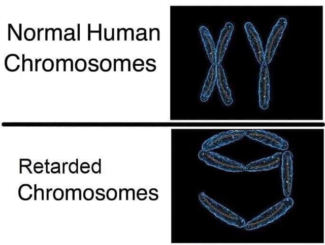 Normal Human Chromosomes Retarded Chromosomes - America’s best pics and ...